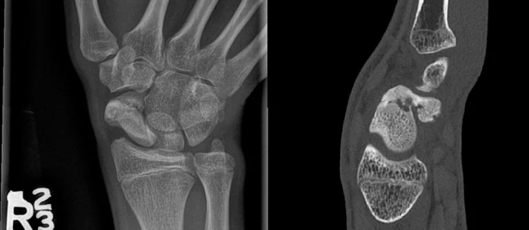 Timely treatment and enhanced imaging improve outc